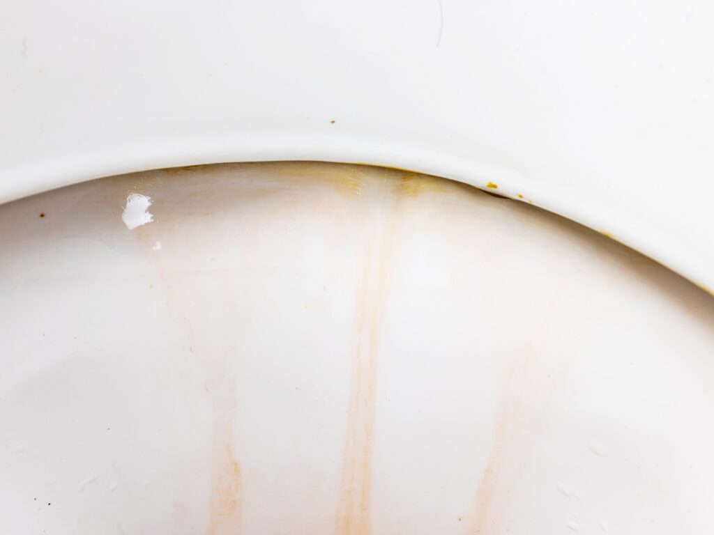 zoomed in image of a toilet with limescale 